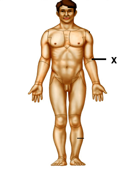 <p>Identify the body area</p>