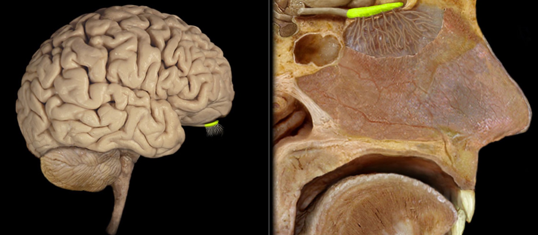 <h4 collapsed="false" seolevelmigrated="true"><strong>Location:</strong></h4><ul><li><p>Lies on cribriform plate of ethmoid bone in anterior cranial fossa</p></li><li><p>Ventral aspect of frontal lobe of brain</p></li></ul><h4 collapsed="false" seolevelmigrated="true"><strong>Description:</strong></h4><ul><li><p>Expanded anterior end of olfactory tract</p></li><li><p>Site of synapse for olfactory neurons (CN I) after their axons pass through cribriform plate</p></li></ul>
