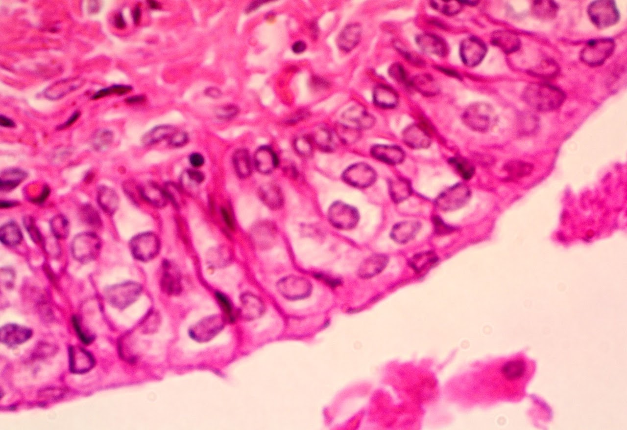 <p>Transitional epithelium</p>