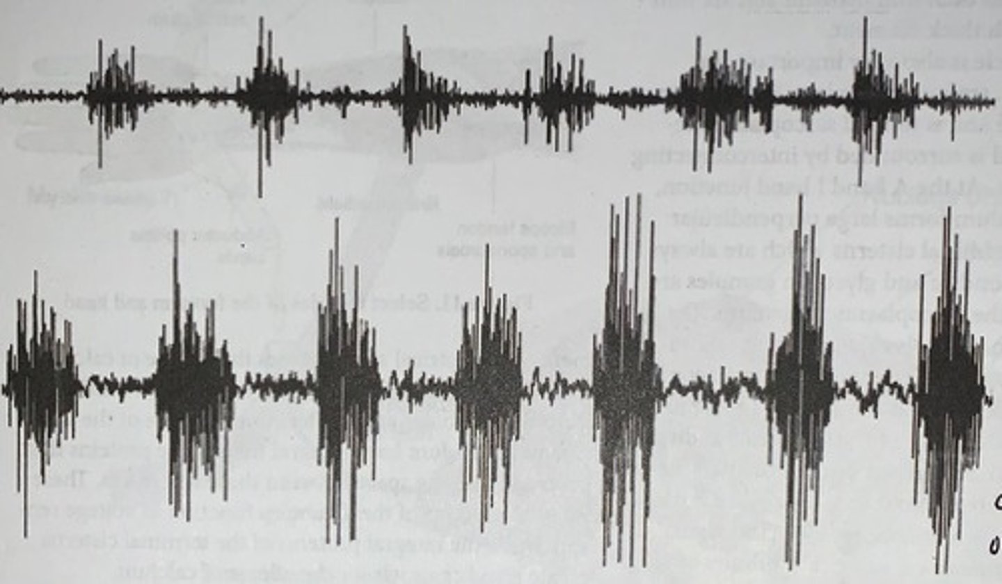 <p>recorded from a small (top) and large (bottom) muscle</p><p>- the magnitude of the electrical signal reflects the number and size of motor units activated</p>