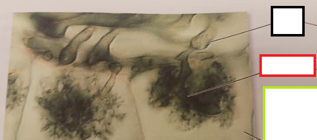 <p>What association/fungi is this showing?</p>