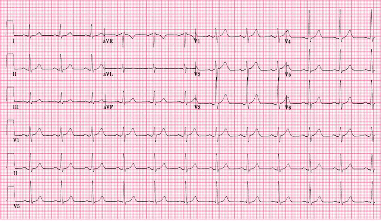 <p>identify axis</p>