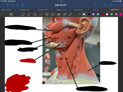 <p>What muscle is this?</p>