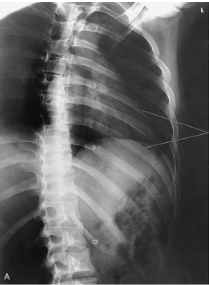 <p>What projection, position and anatomy is this?</p>
