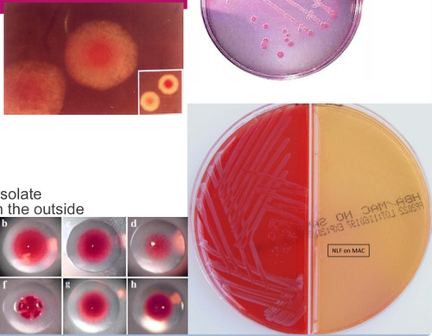 <p>GNB, most common GIT pathogen, enterbacterales, oxidase neg, fermentative, PYR pos, use CIN media to isolate, bull's eye colony - dark pink in middle, clear on outside</p>