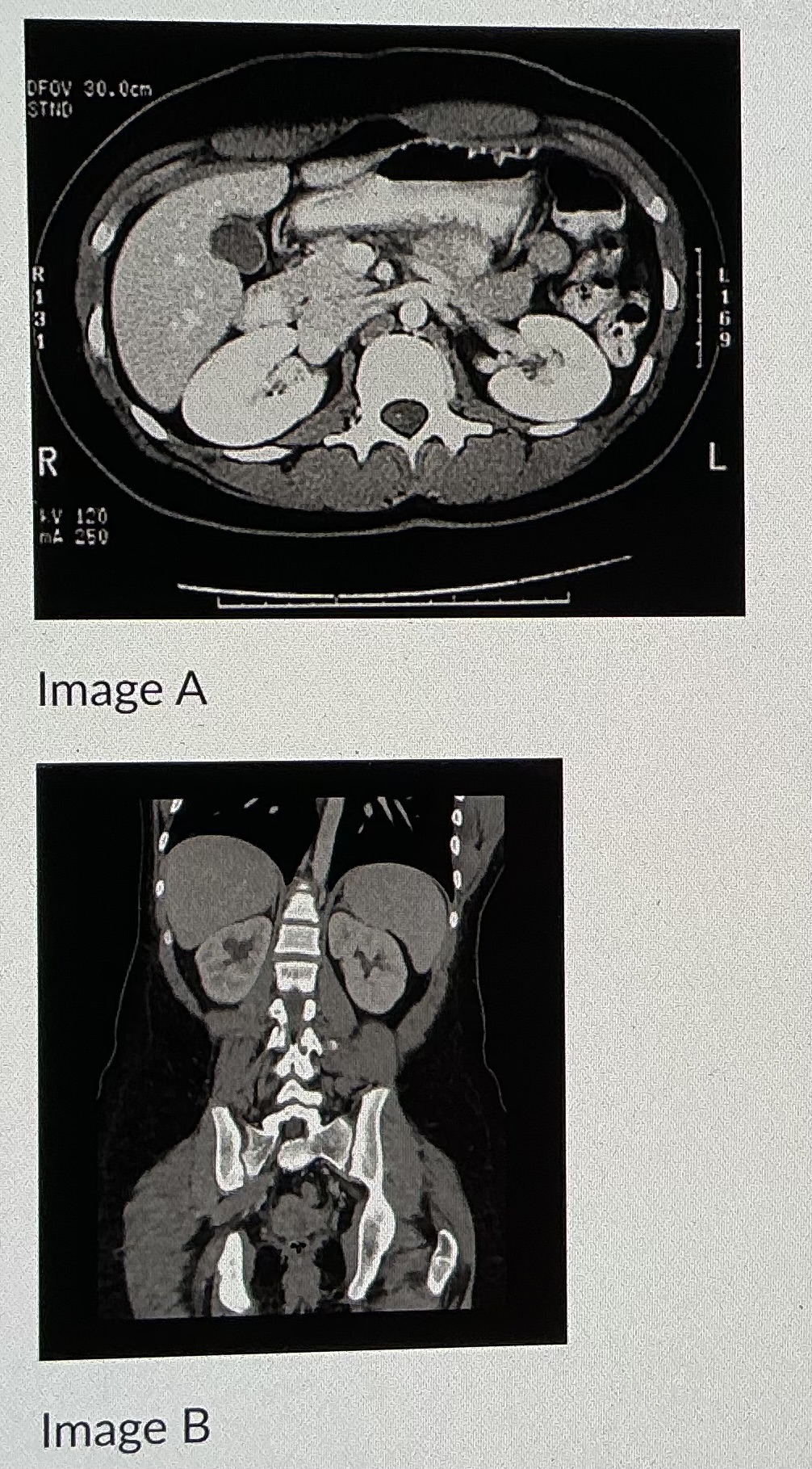 <p>Image B shows an image taken in what plane</p>
