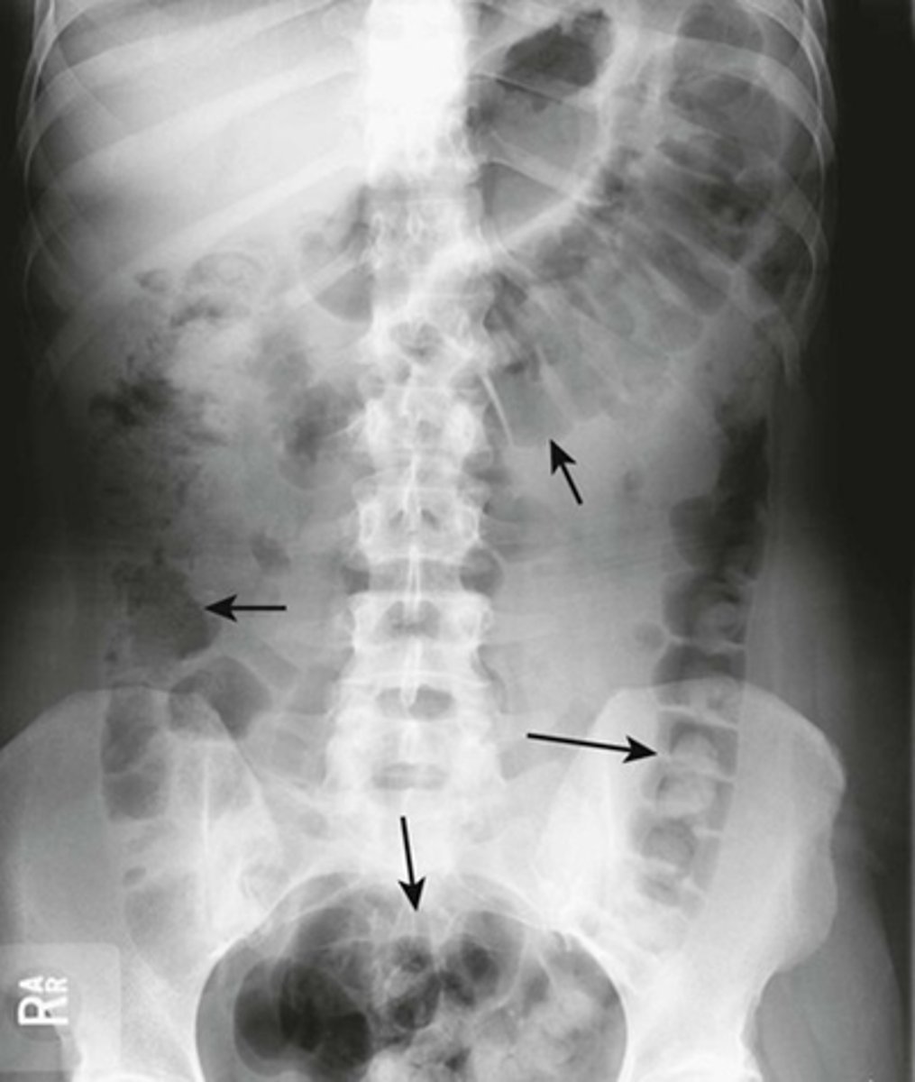 <p>What are the black arrows pointing to?</p>