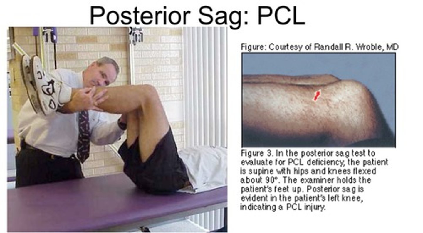 <p>What does it test for?</p><p>- torn PCL</p><p>How do you perform it?</p><p>- bend knee at 90 degree</p><p>- increased posterior gliding of tibia = PCL injury</p>
