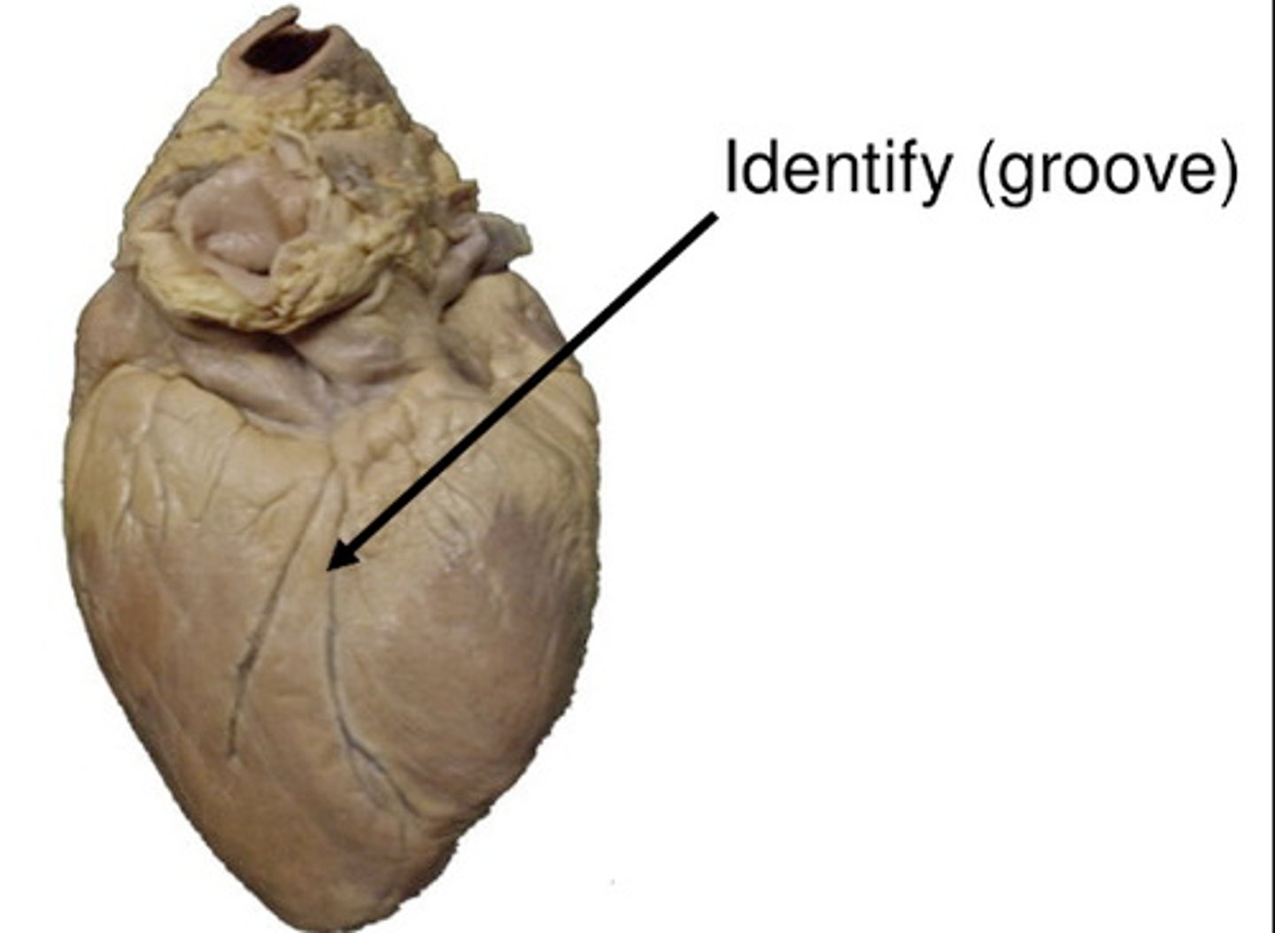 <p>Marks the boundary between the ventricles posteriorly.</p>