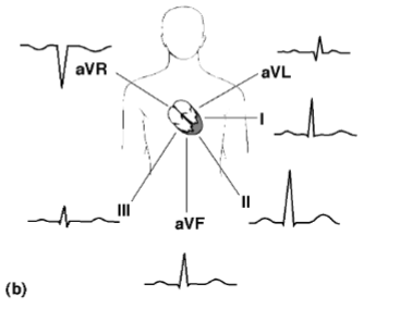 <p>The unipolar (aV) and bipolar limb leads (standard) record electrical activity of the heart in the frontal plane of the body</p><p><strong>The main deflection is positive for all leads except the aVR</strong></p>