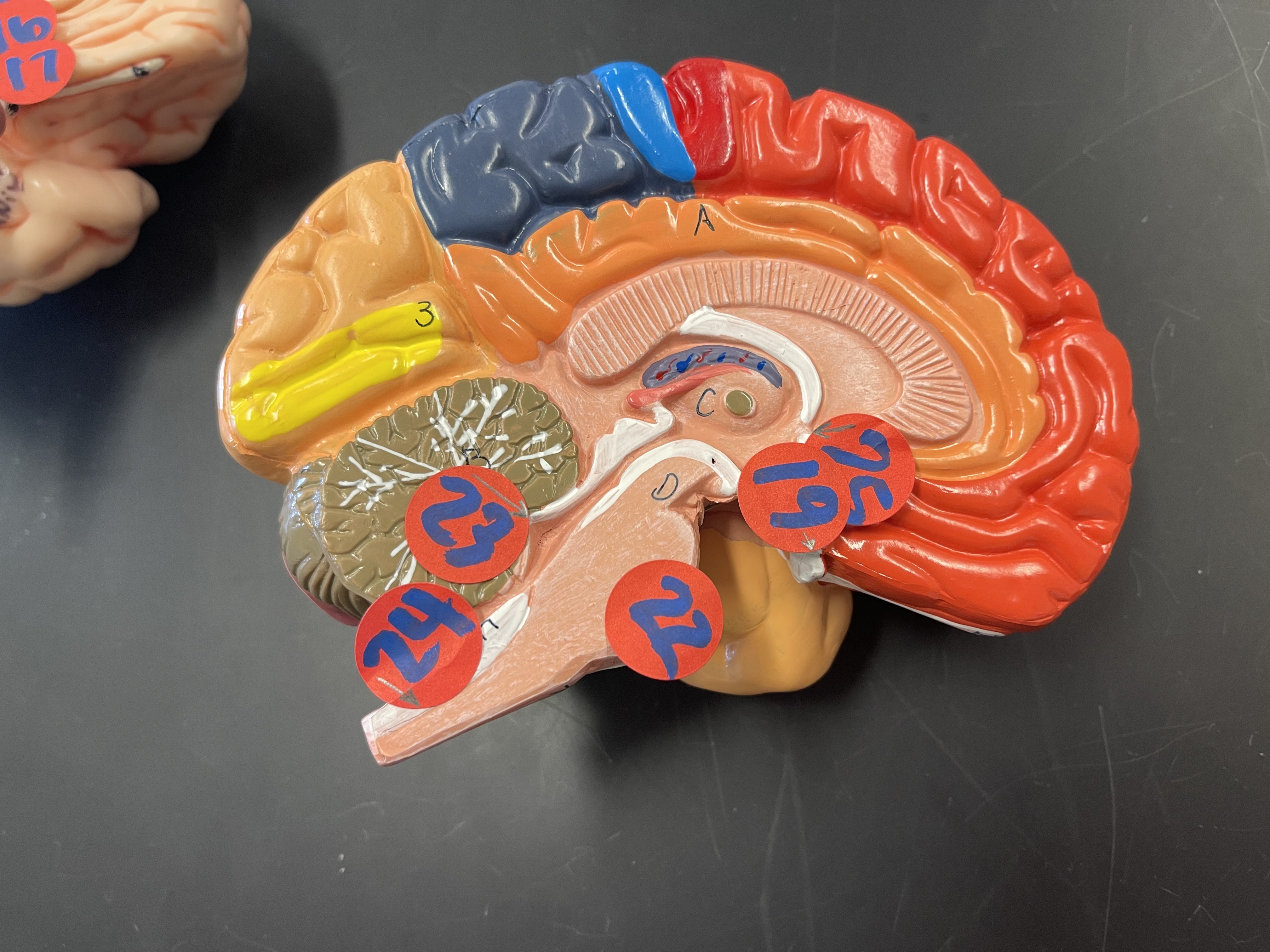 25) name the connecting hole (CSF flow) 