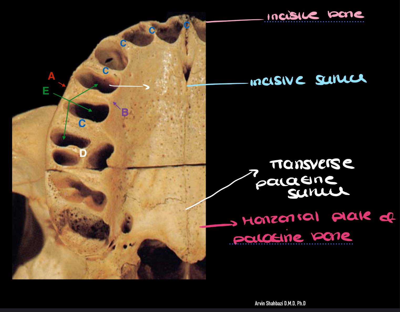 <p>label the diagram + what is the role of the interdental bony septa ? </p>