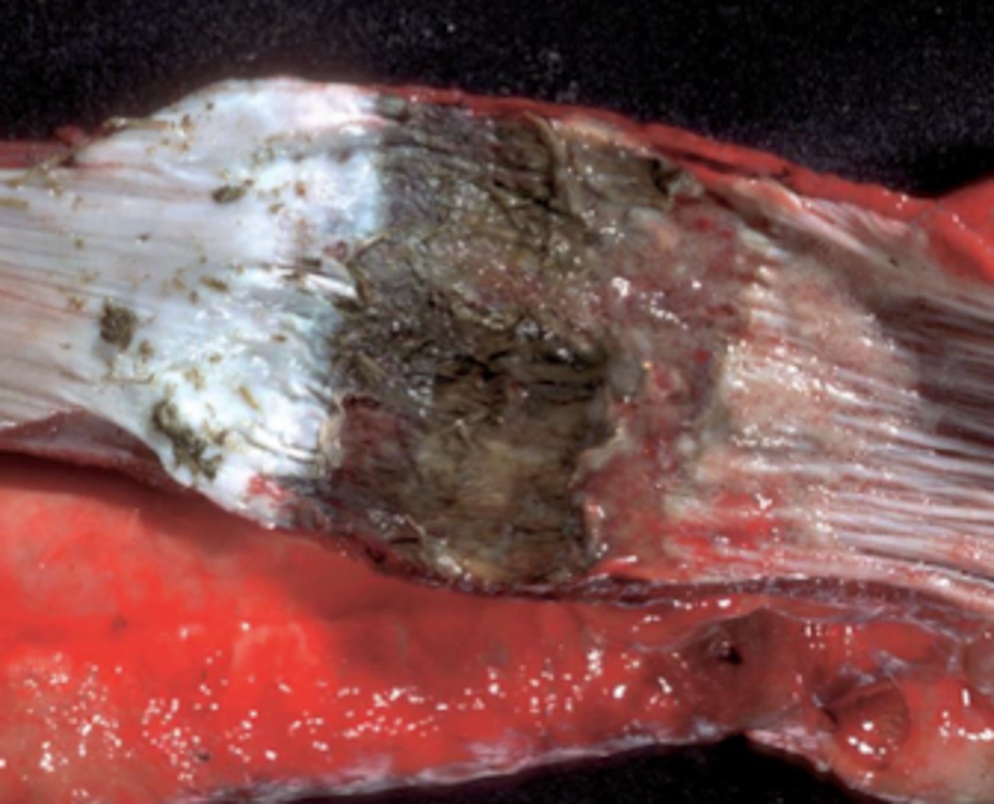 <p>¿diagnóstico morfológico?</p><p>¿causa probable?</p>