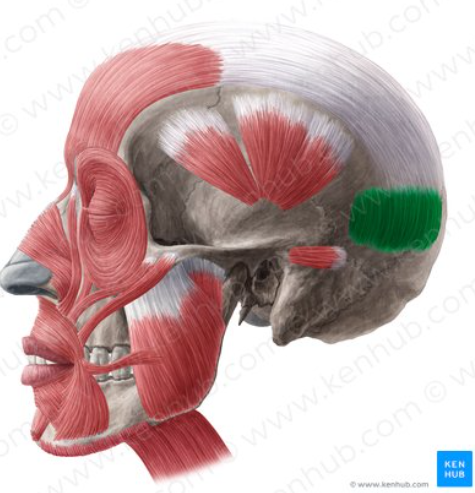 term image