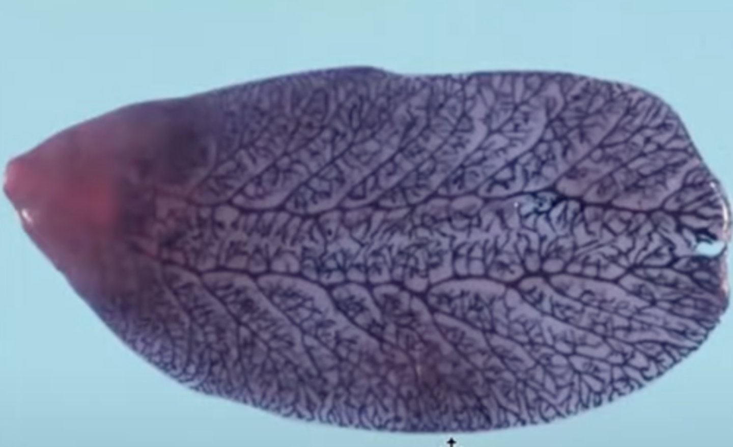 <p>What is this adult leaf-shaped parasite called?</p>