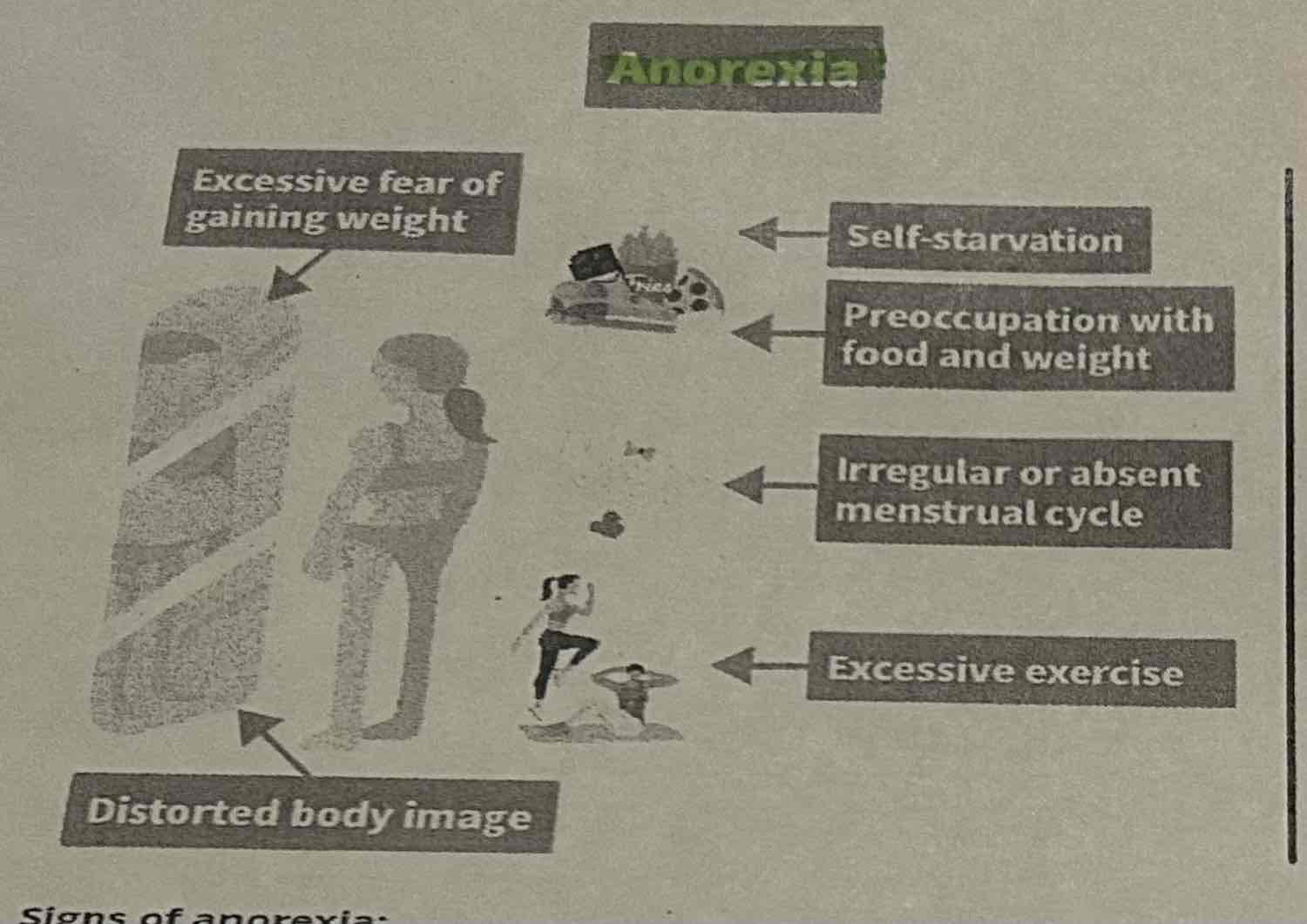 <p><span>Signs of anorexia:</span></p><ul><li><p><span>﻿﻿Self-starvation</span></p></li><li><p><span>﻿﻿Preoccupation with food and weight</span></p></li><li><p><span>﻿﻿Extreme fear of gaining weight</span></p></li><li><p><span>﻿﻿Excessive exercise</span></p></li><li><p><span>﻿﻿Distorted body image</span></p></li><li><p><span>﻿﻿Irregular or absent menstrual cycles</span></p></li></ul>