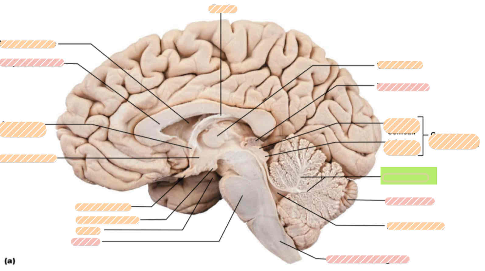 <p><span>Human brain</span></p>