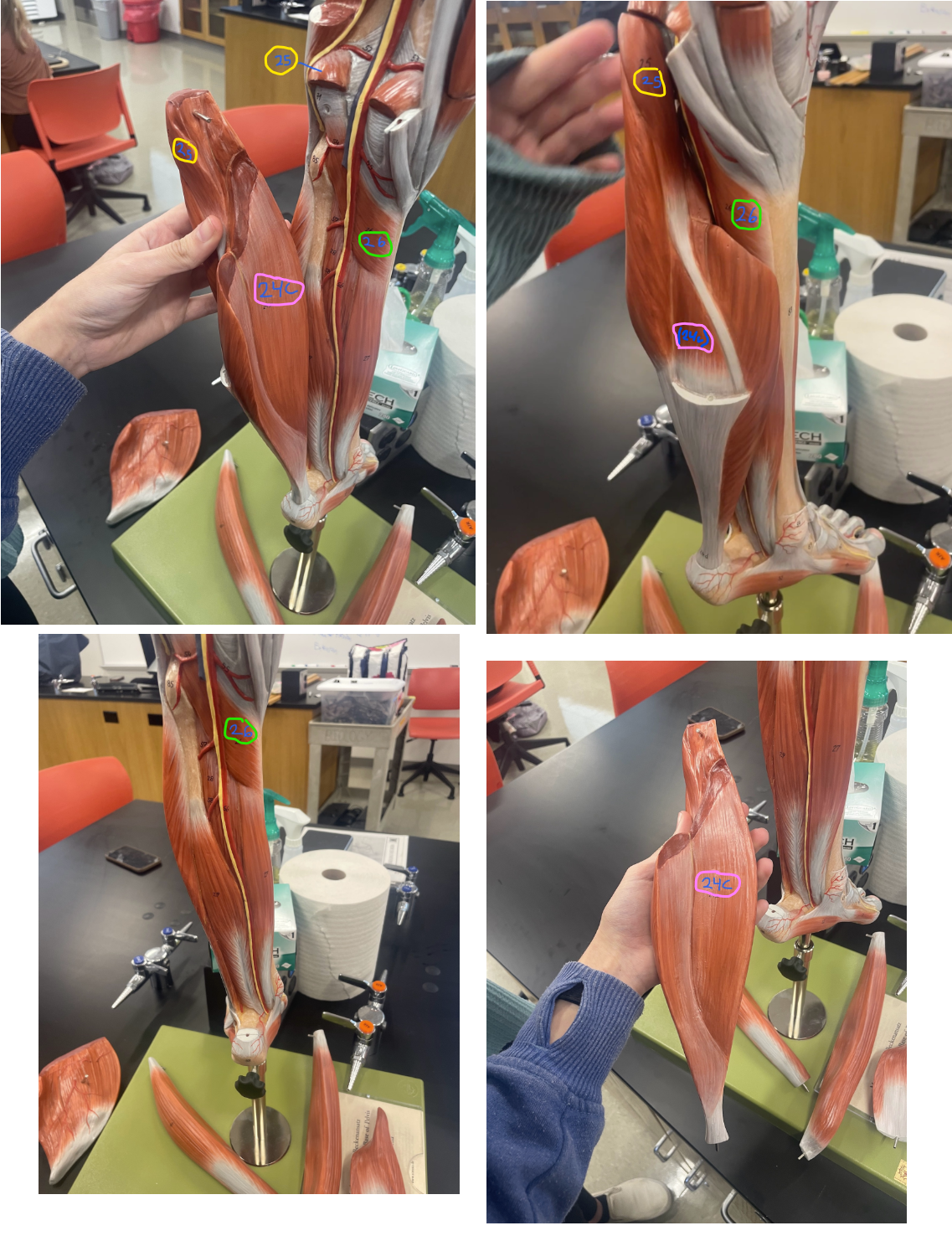 <p>what muscle is #25 (circled in yellow)</p>