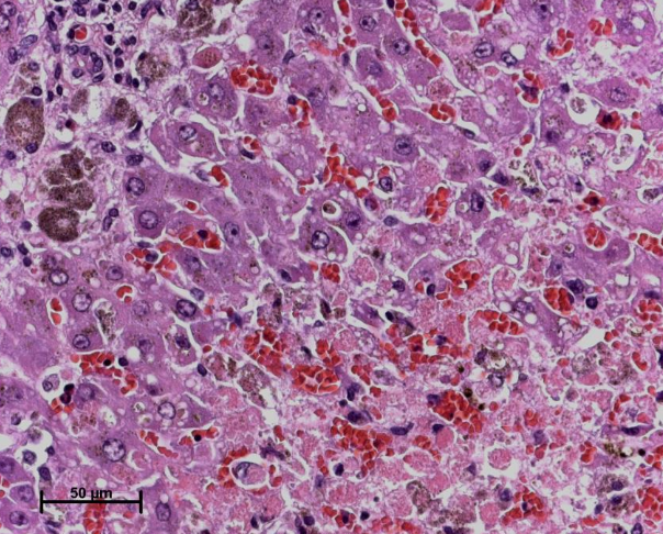 <p><strong>hepatic necrosis, varying patterns, </strong>granular gray-green pigement within Kupffer cells</p><p>acute renal tubule <strong>degeneration and necrosis with hemoglobin casts </strong>(due to hypoxia or hemoglobin)</p><p>gastroenteritis if acute </p>