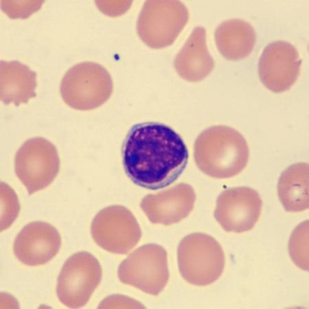 <p>What is this leukocyte?</p>