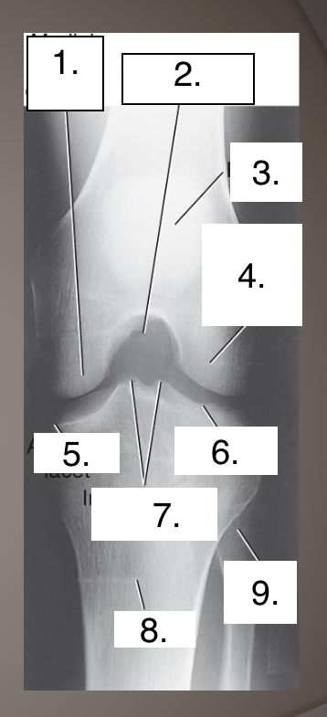 <p>Projection? </p><p>Label?</p>