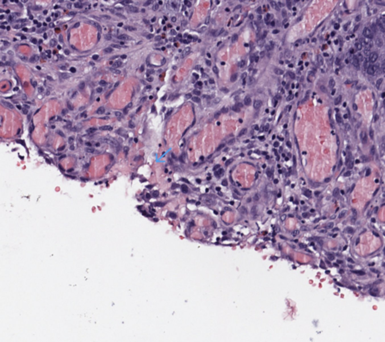 <p>Stomach</p>