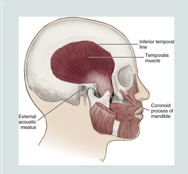 <ul><li><p>a fan shaped muscle</p></li><li><p>main function is to move the mandible </p></li><li><p><strong>originates from the temporal fossa and inserts at the coronoid process of the mandible</strong></p></li><li><p>its fibers pass deep to zygomatic arch to attach to mandible</p></li></ul><p></p>