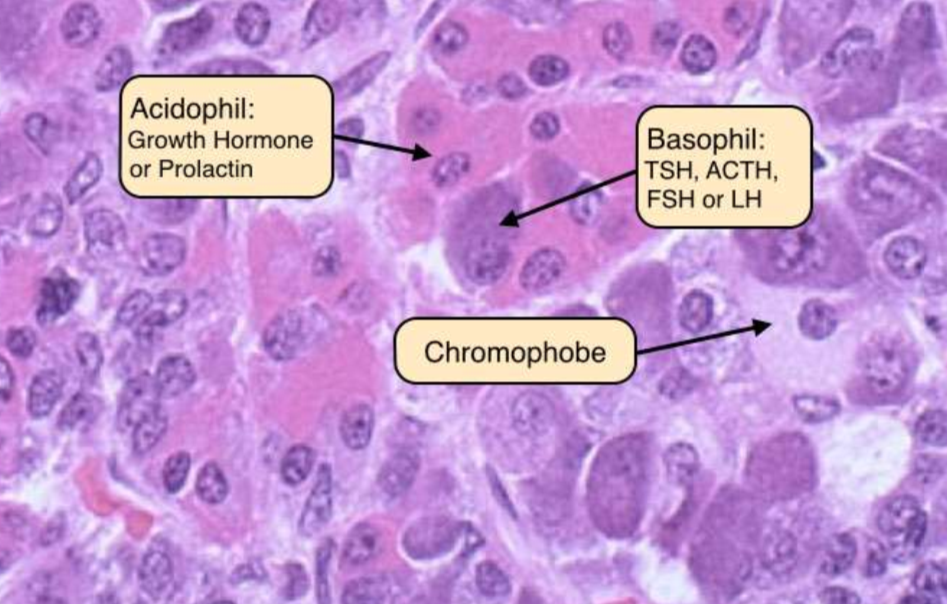 <p>are cuboidal to columnar epithelial cells that secrete various hormones such as GH, ACTH, TSH, FSH, and LH. </p>