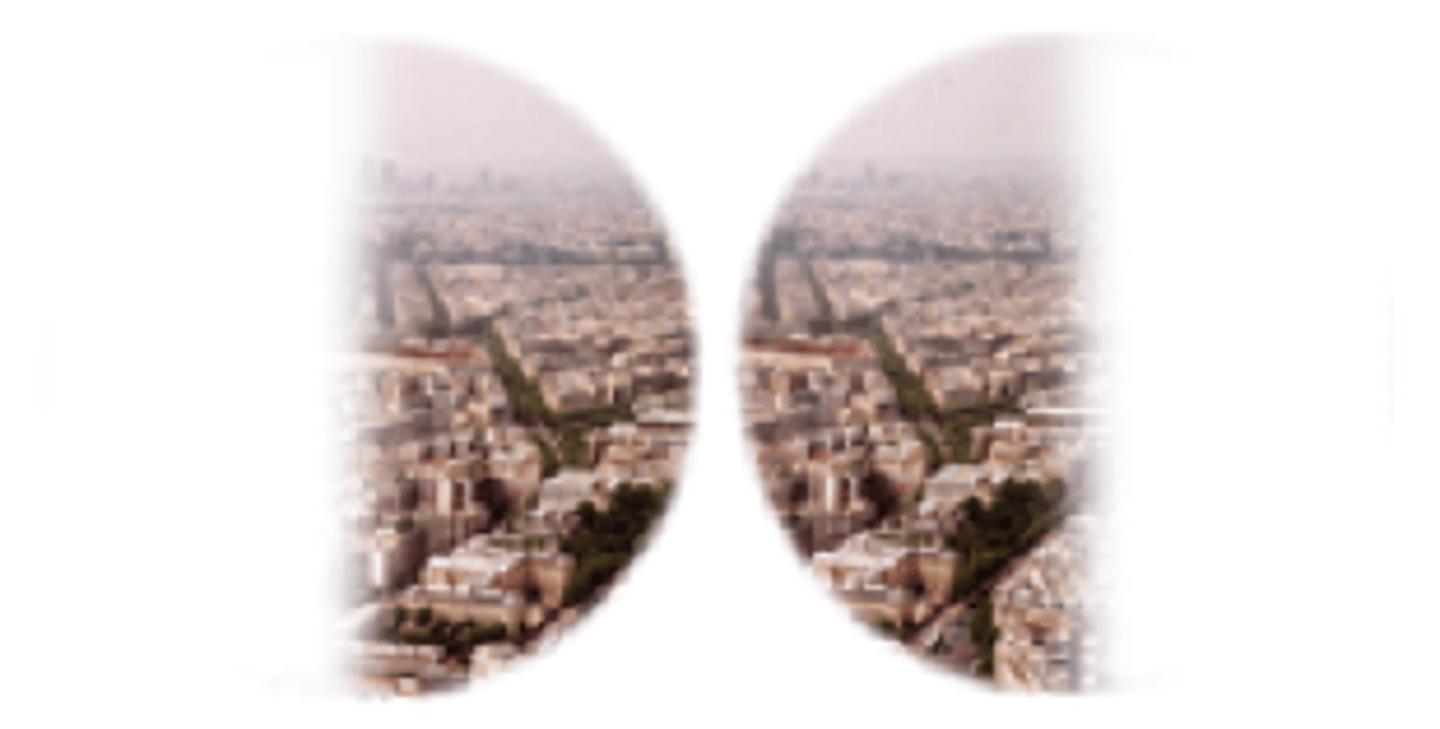 <p>Loss of lateral peripheral fields due to optic chiasm compression (often from a pituitary adenoma)</p>