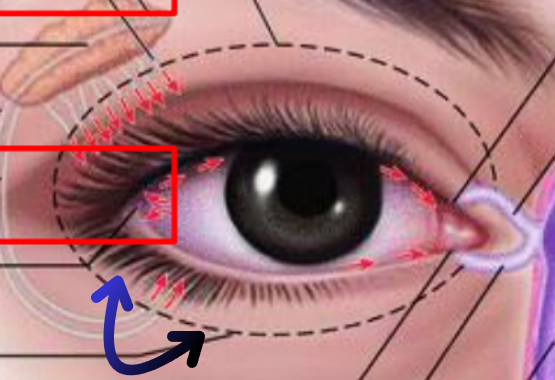 term image