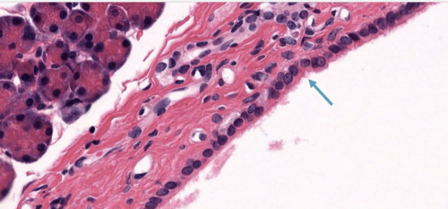 <p>Identify the type of epithelia</p>