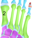 <p>Metatarsal bones</p>