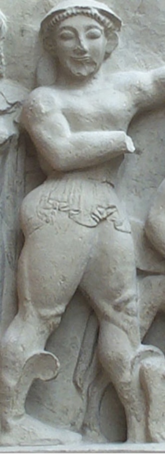 <p>How is detail created in the figure of Perseus? Good and Bad (3 Points)</p>
