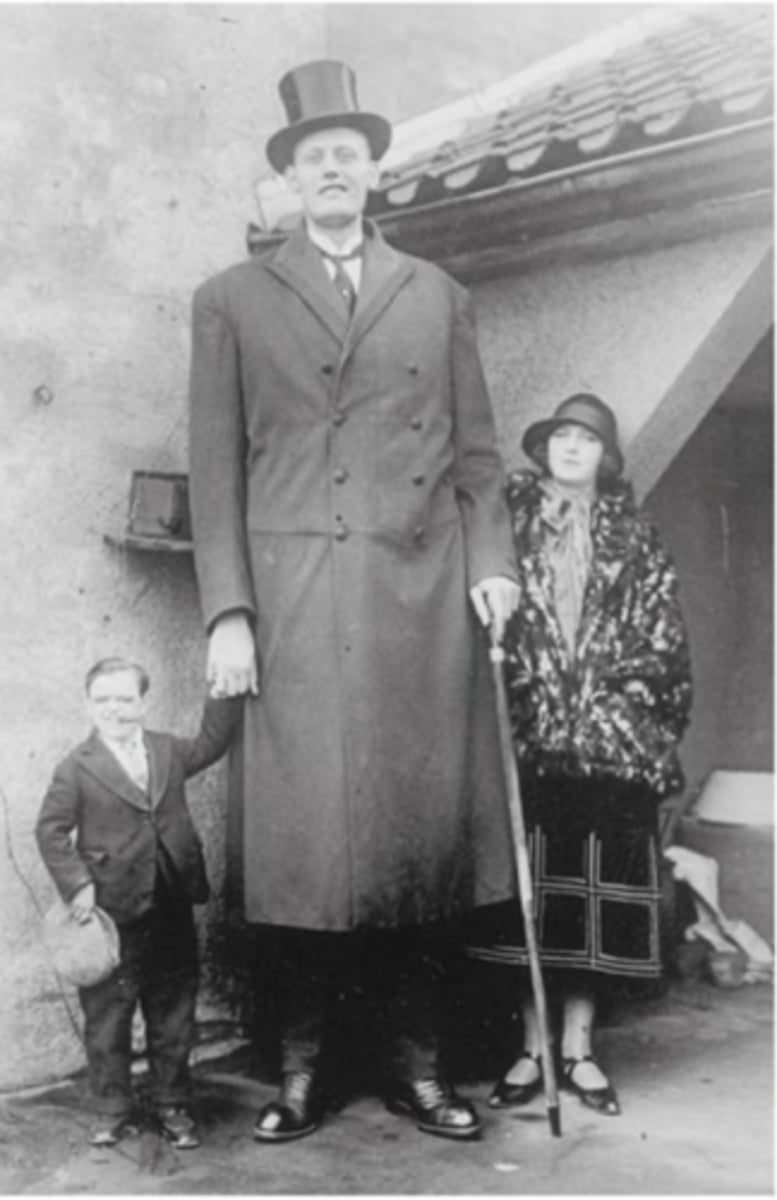 <p>excess in GH prior to puberty and fusion of epiphysis</p>