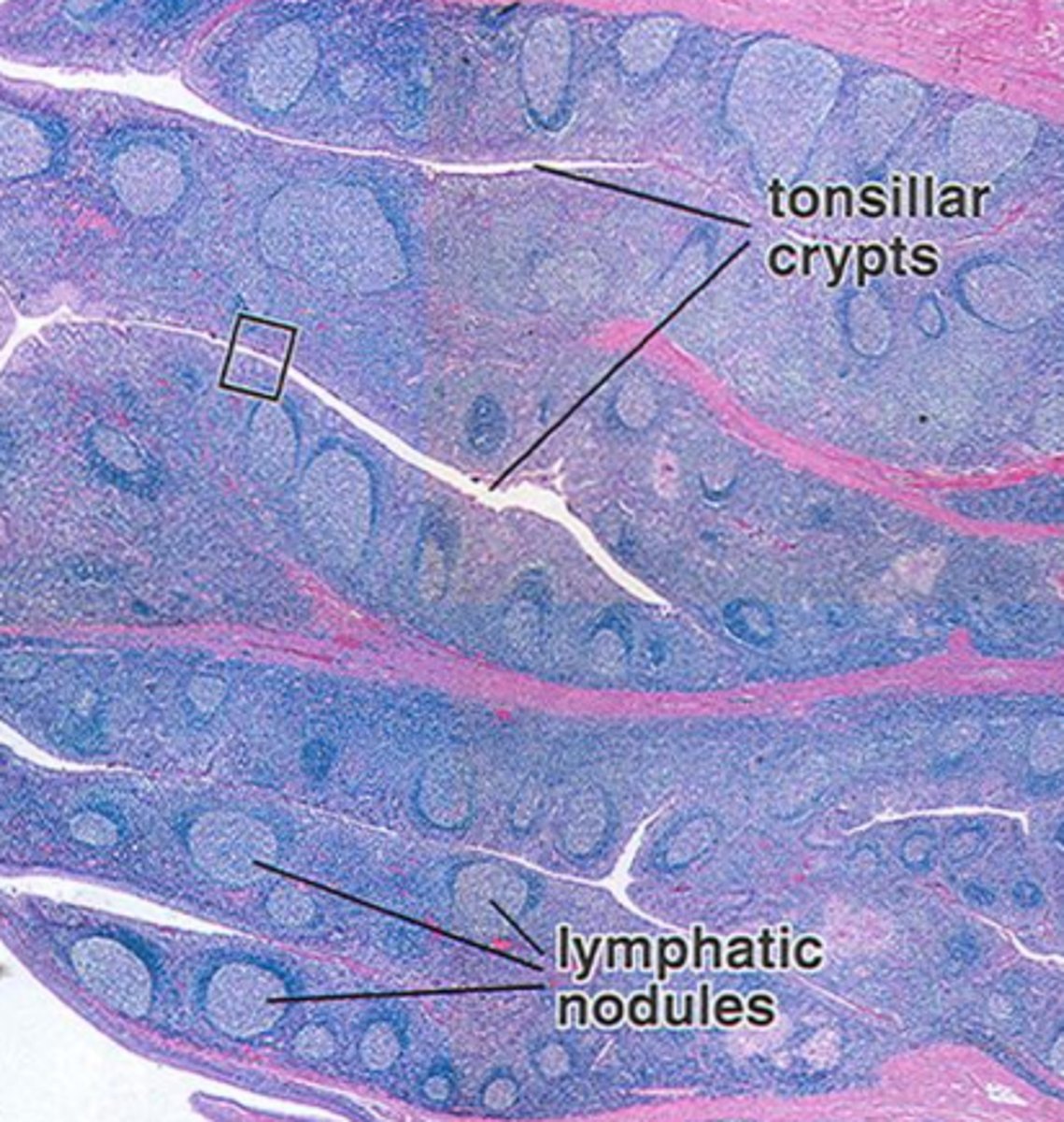 <p>portion of tonsils that trap and destroy bacteria and particulate matter.</p>