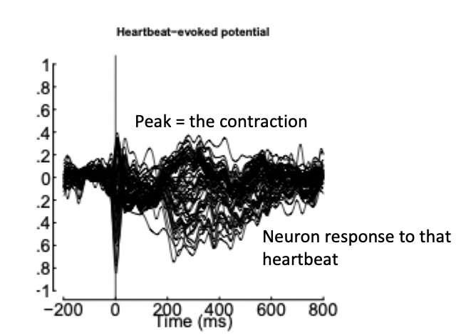 <ul><li><p>no significant difference in interoceptive accuracy</p></li><li><p>but significant differences in interoceptive neural processing</p></li><li><p>disturbance of interoceptive signal processing found at the level of cortical representation → difference in the way the brain is processing the heartbeats in AN patients</p></li></ul><img src="https://knowt-user-attachments.s3.amazonaws.com/15a90b9e-7c63-41ac-a81f-c38084c7b1fc.png" data-width="100%" data-align="center"><p></p>