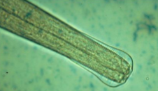 <p>the dose-limiting parasite of the trichostongyle type parasite in cattle</p>