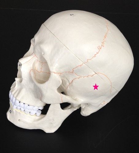 <p>Identify the bone.</p>