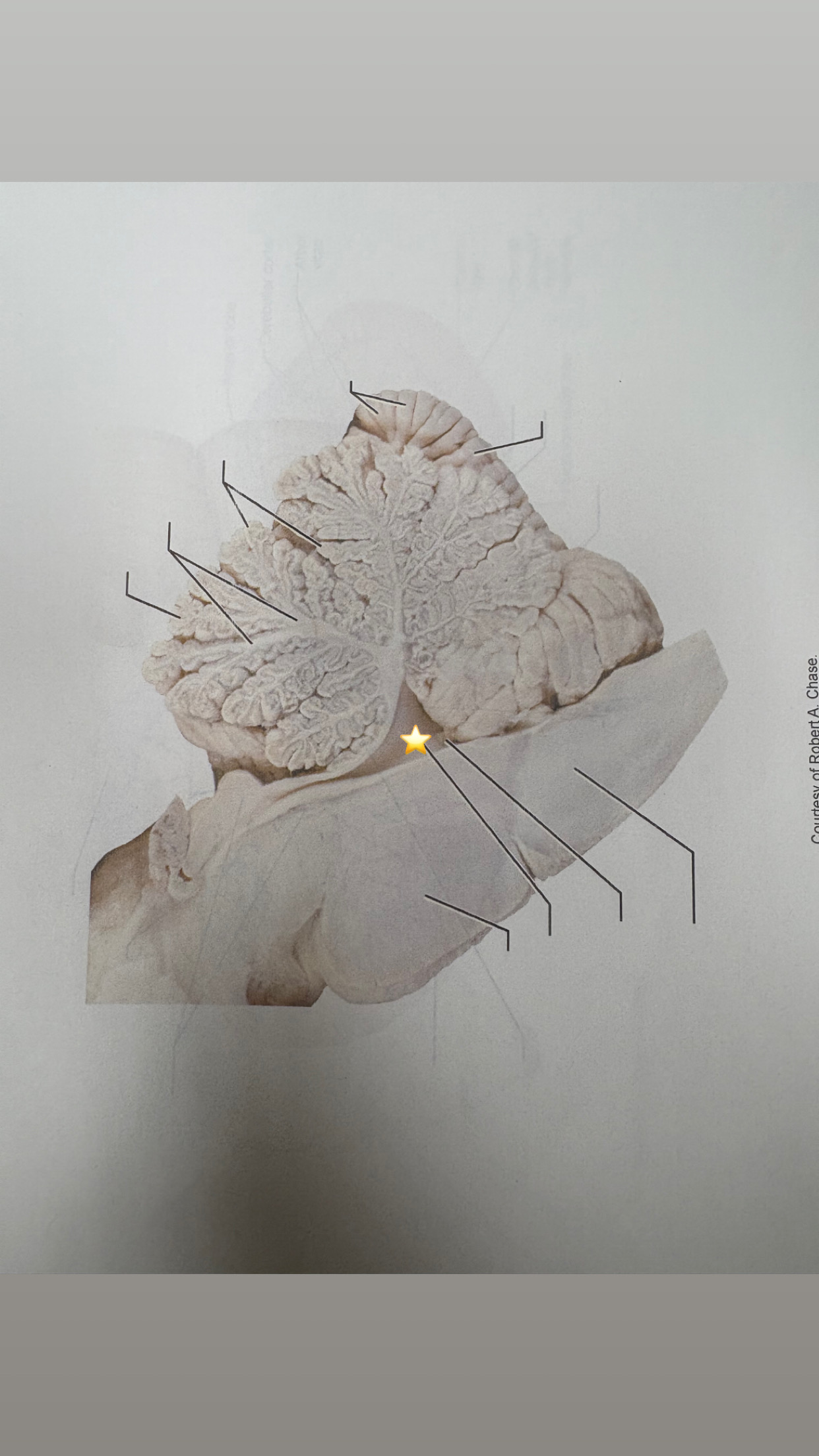 <p>name the starred structure</p>