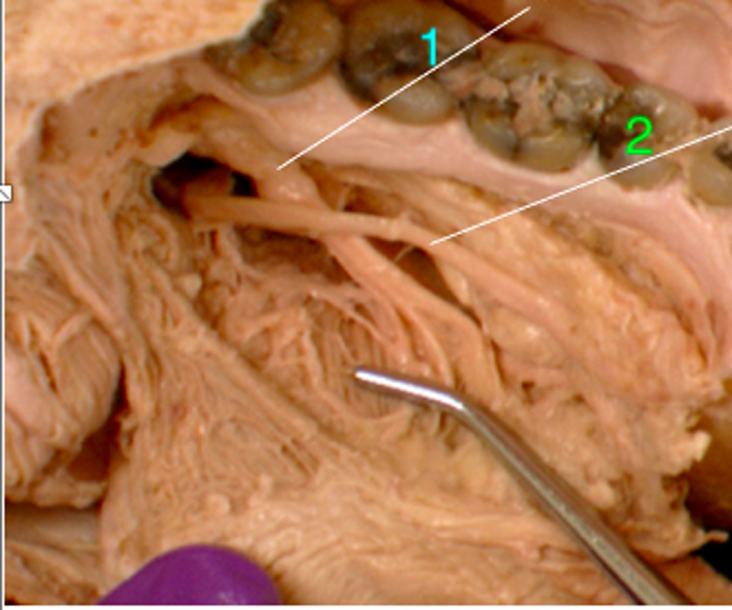 <p><em>identify structure #1</em></p>