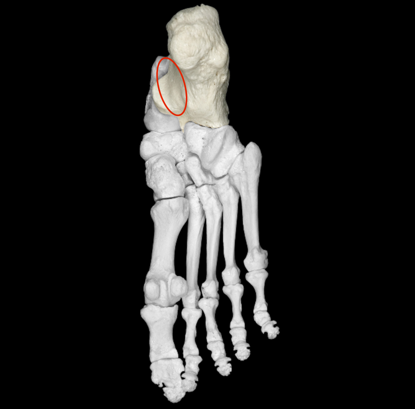 <p>groove on medial/inferior side </p>