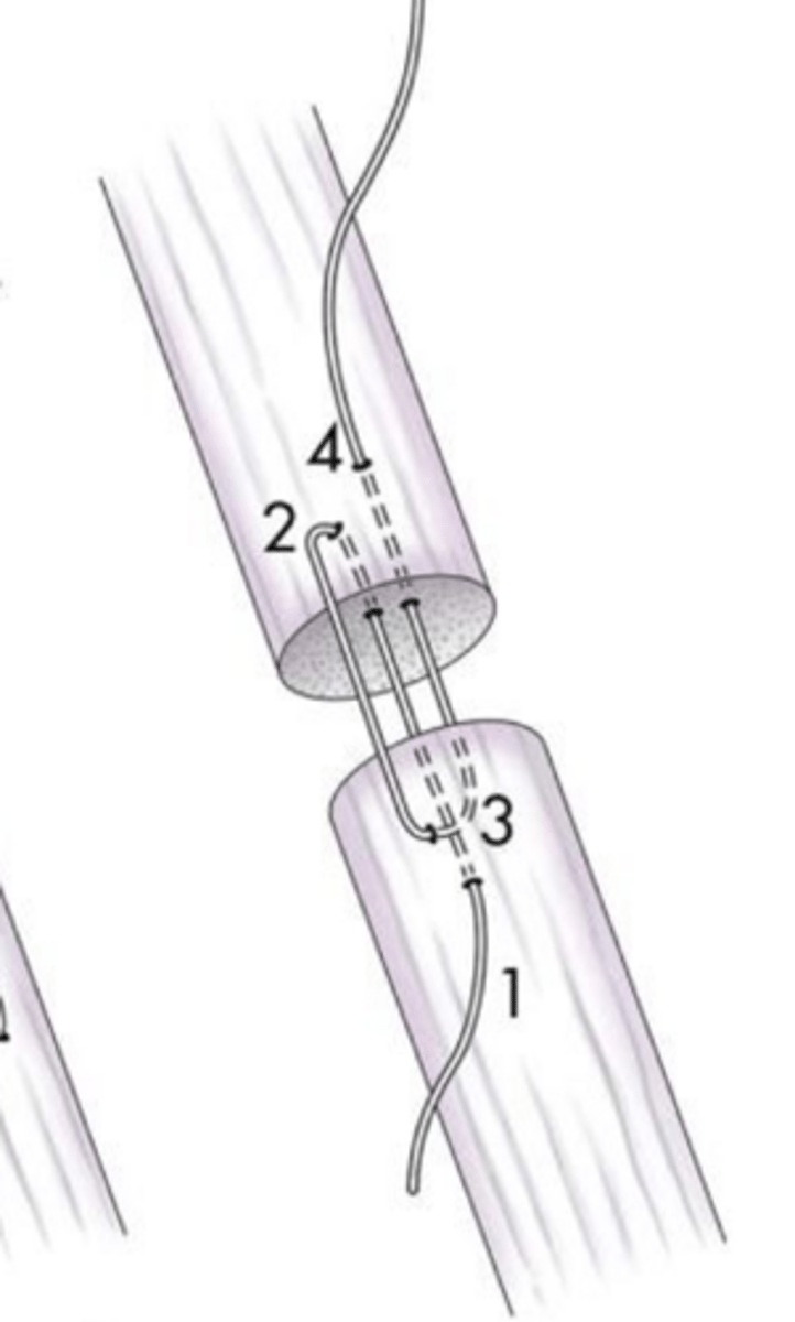 <p>what ligament/tendon suture pattern is shown here</p>