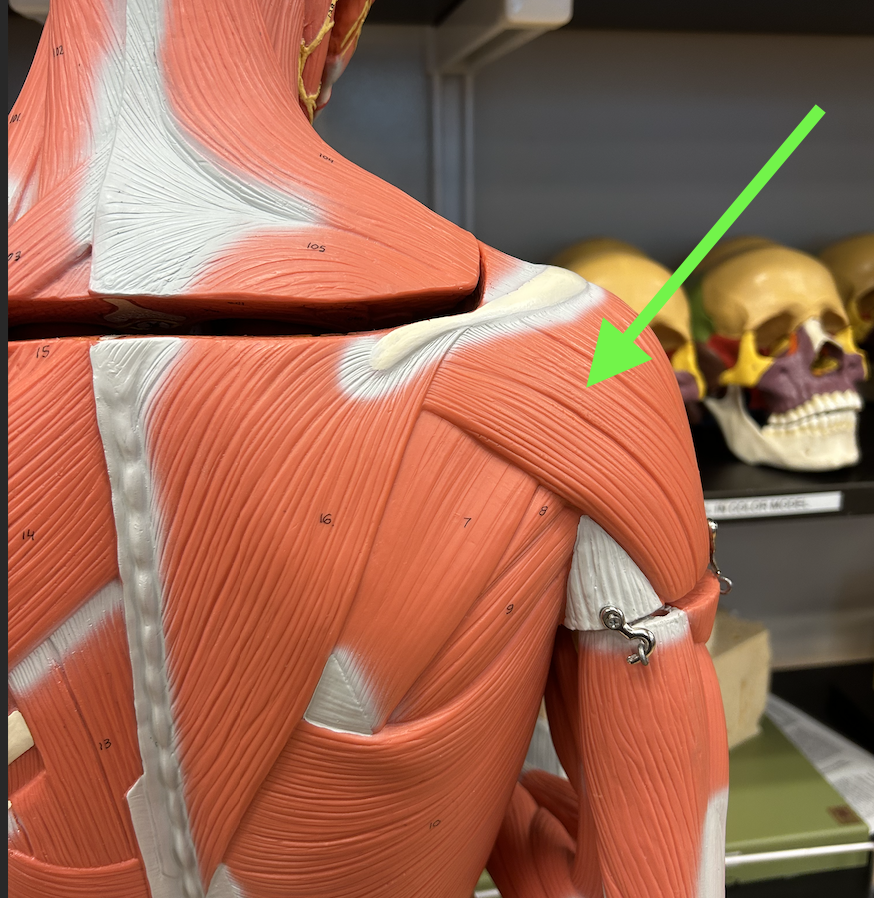 term image