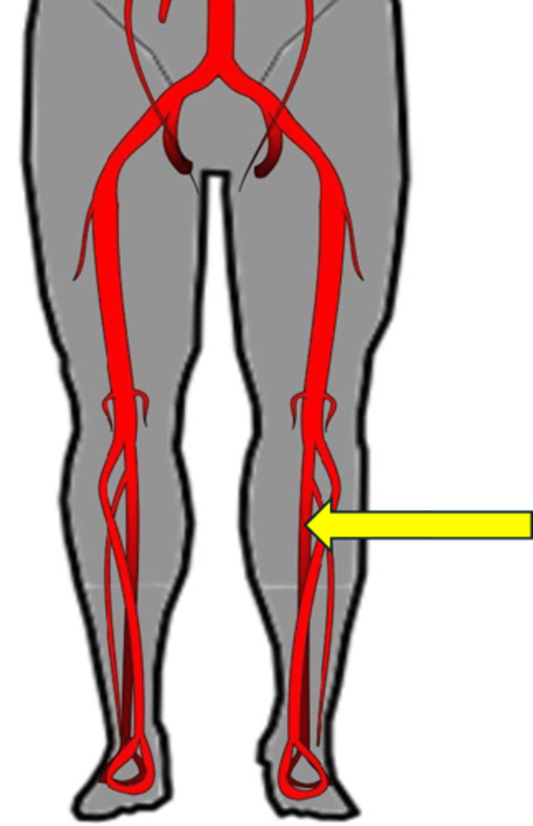 <p>Name the red vessel</p>