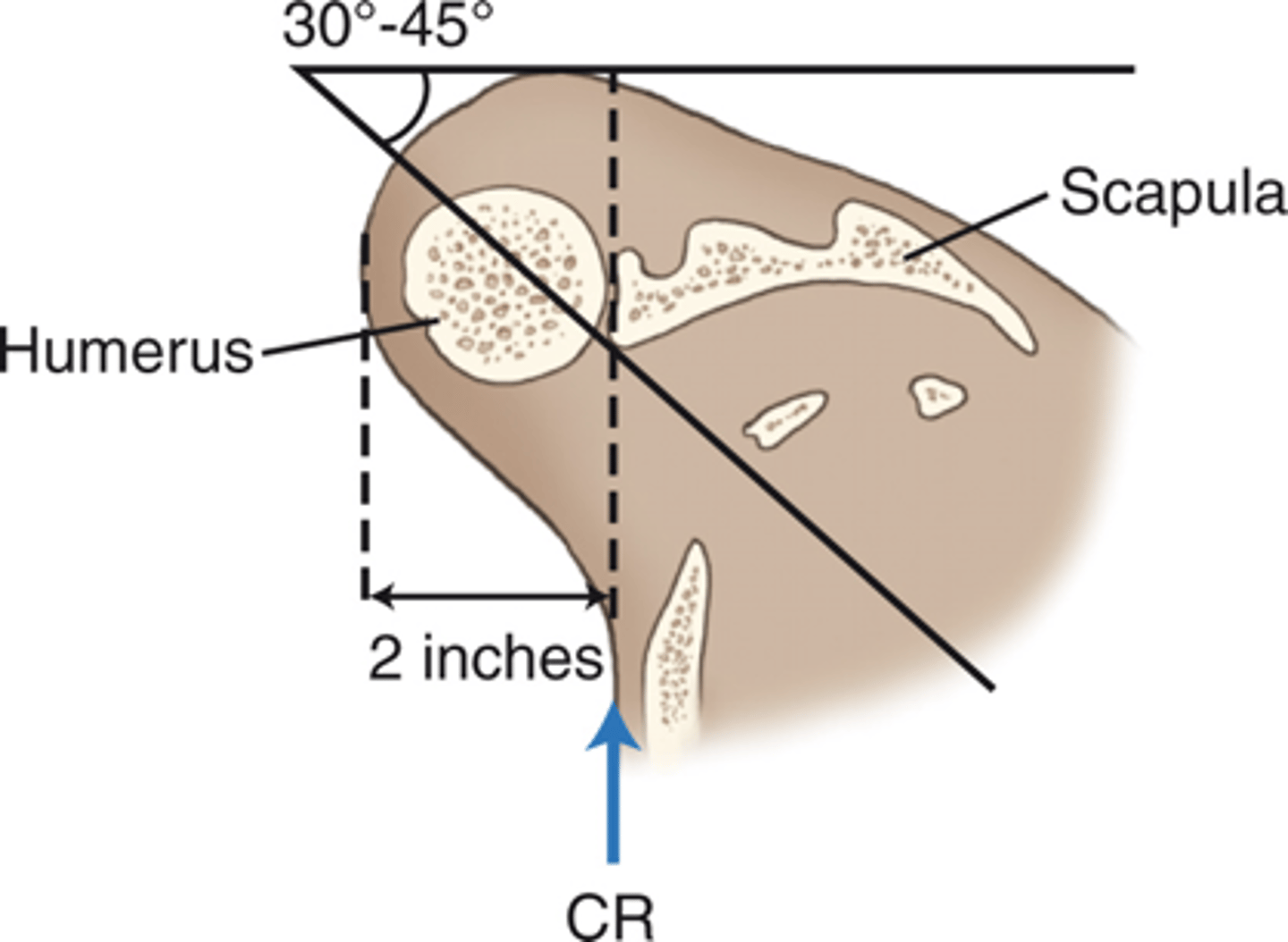 <p>- 35° to 45° oblique</p><p>- CR perpendicular to IR 2 inches (5 cm) inferior and medial from superolateral border of humerus</p>