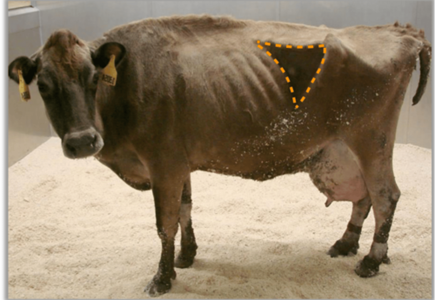 <p>what part of the GIT is accessed by the L paralumbar fossa</p>