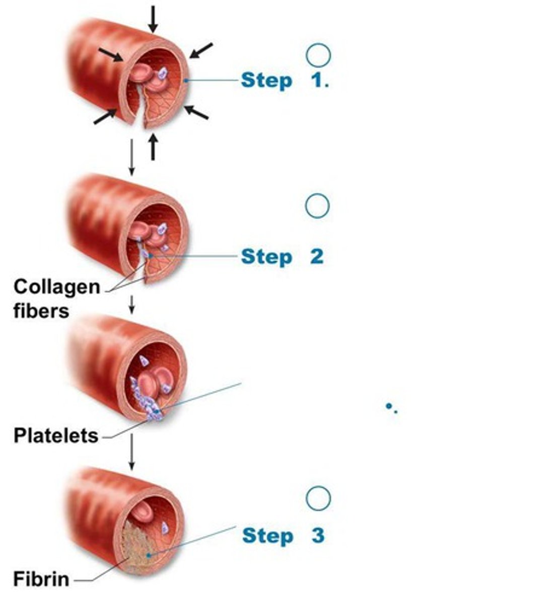 <p>Step 1: Vascular spasm </p><p>Step 2: Platelet plug formation</p><p>Step 3: Coagulation (blood clotting)</p>