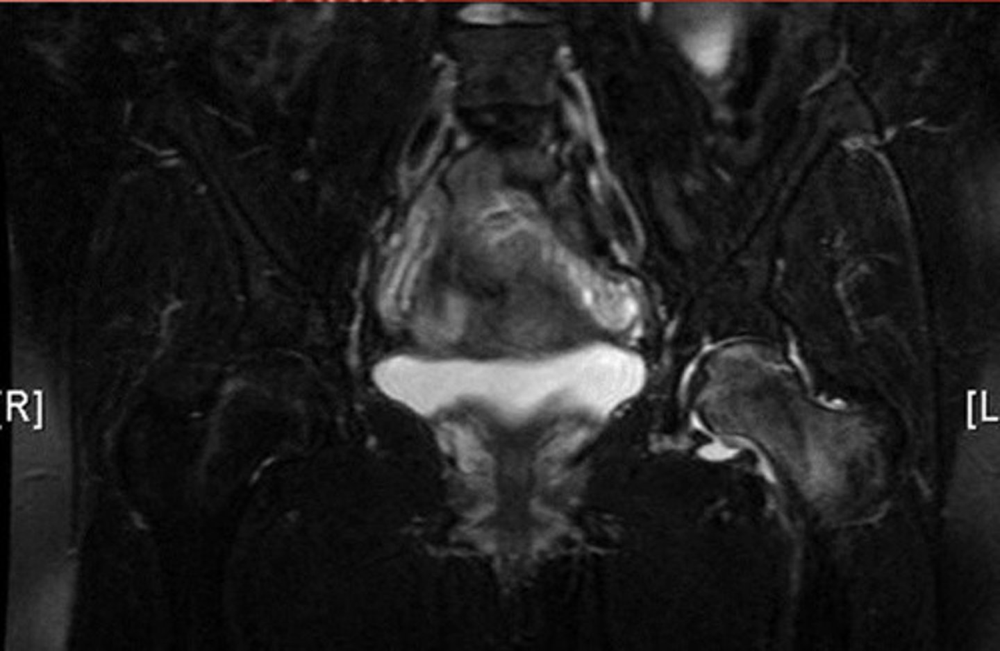<p>What is this imaging?</p><p>What condition?</p>