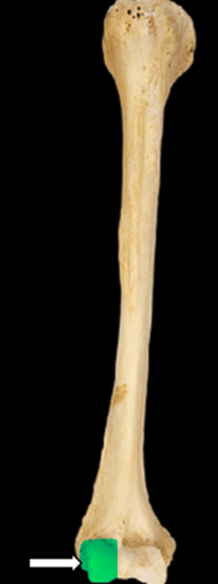 <p>name the part</p>