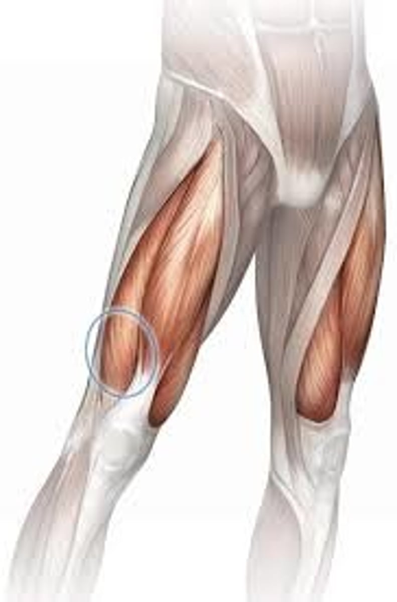 <p>lateral side of quad, fibers run diagonally</p>
